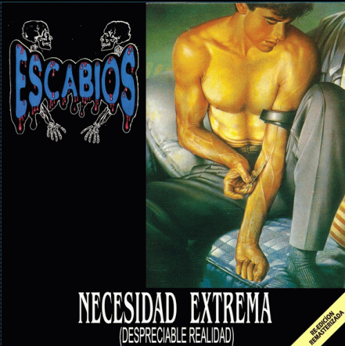 Escabios : Necesidad Extrema